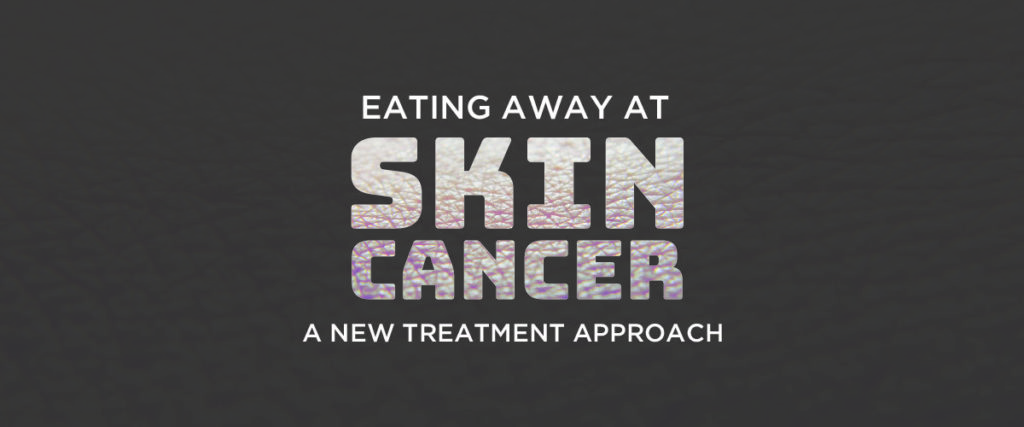 Eating Away At Skin Cancer A New Treatment Approach